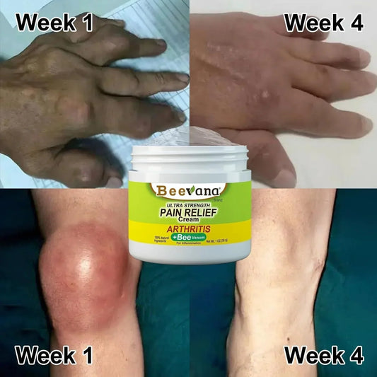 30 DAY MONEY BACK OFFER!! (Pack Of 3) BeeTherapy™ #1 Bee Venom Pain Relief Cream Buy 1 Get 1 Free!